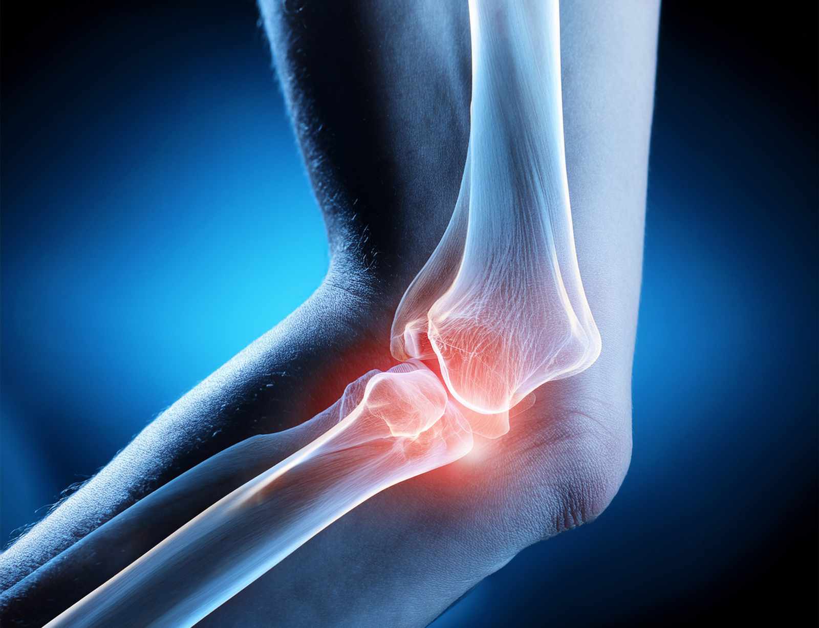 Ellbogenbeschwerden 2 Ellenbogenbeschwerden Knochen