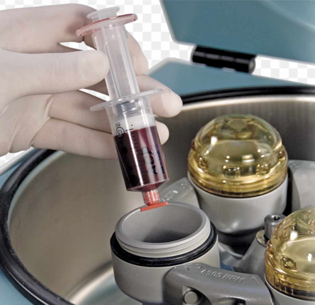 Eigenbluttherapie 2 eigenblut2